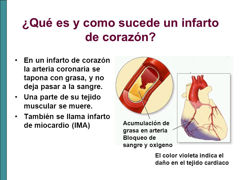 ¿Qué es y como sucede un infarto de corazón