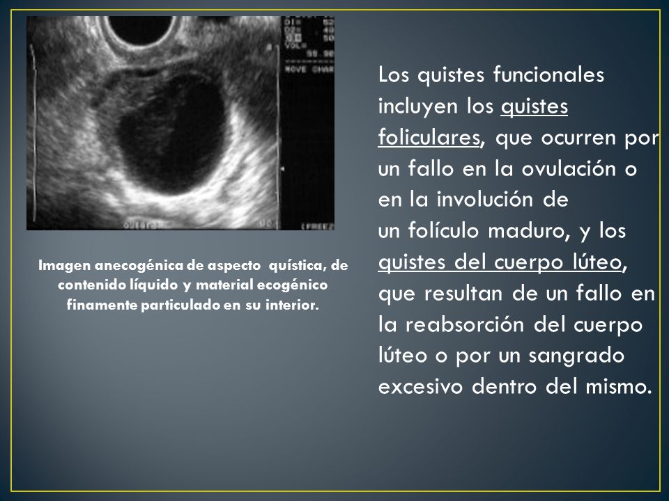 Los quistes funcionales incluyen los quistes foliculares, que ocurren por un fallo en la ovulación o en la involución de un folículo maduro, y los quistes del cuerpo lúteo, que resultan de un fallo en la reabsorción del cuerpo lúteo o por un sangrado excesivo dentro del mismo.