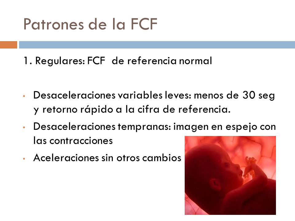 Patrones de la FCF 1. Regulares: FCF de referencia normal