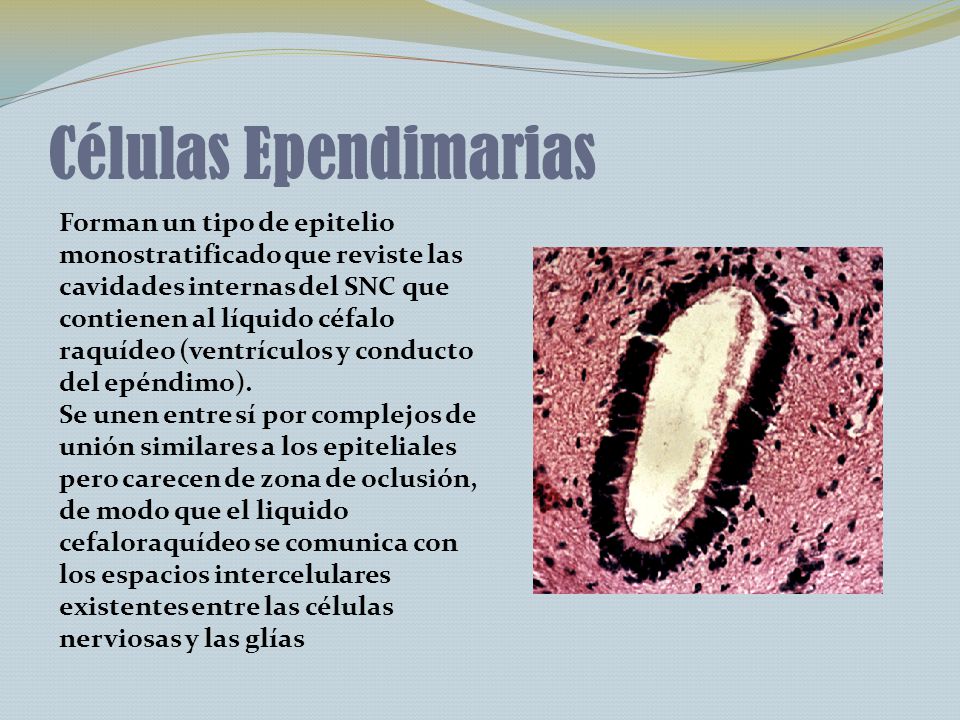 Células Ependimarias