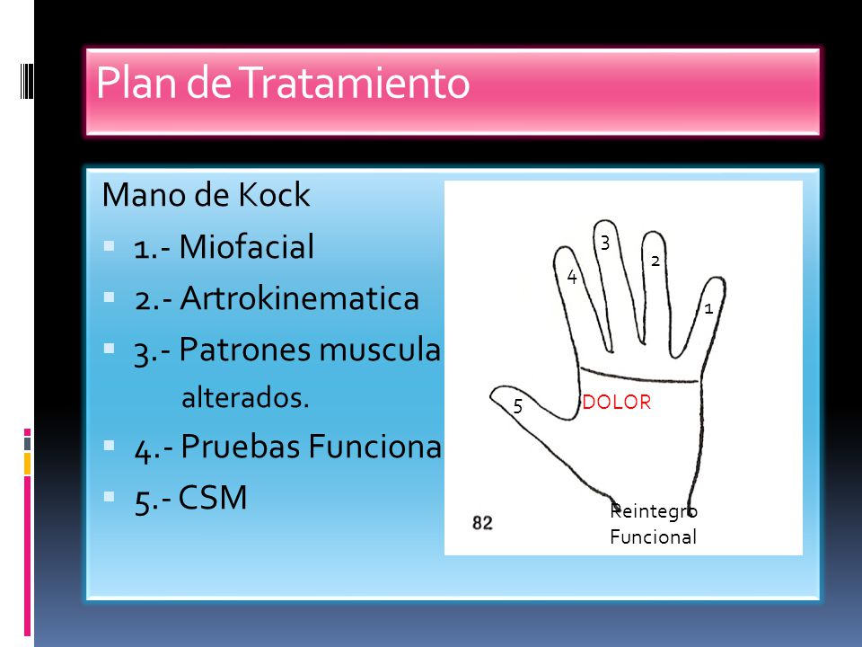 Plan de Tratamiento Mano de Kock 1.- Miofacial 2.- Artrokinematica