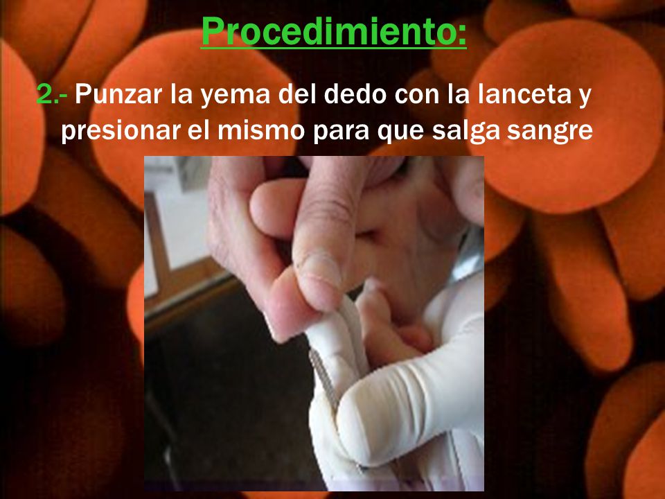 Procedimiento: 2.- Punzar la yema del dedo con la lanceta y presionar el mismo para que salga sangre.