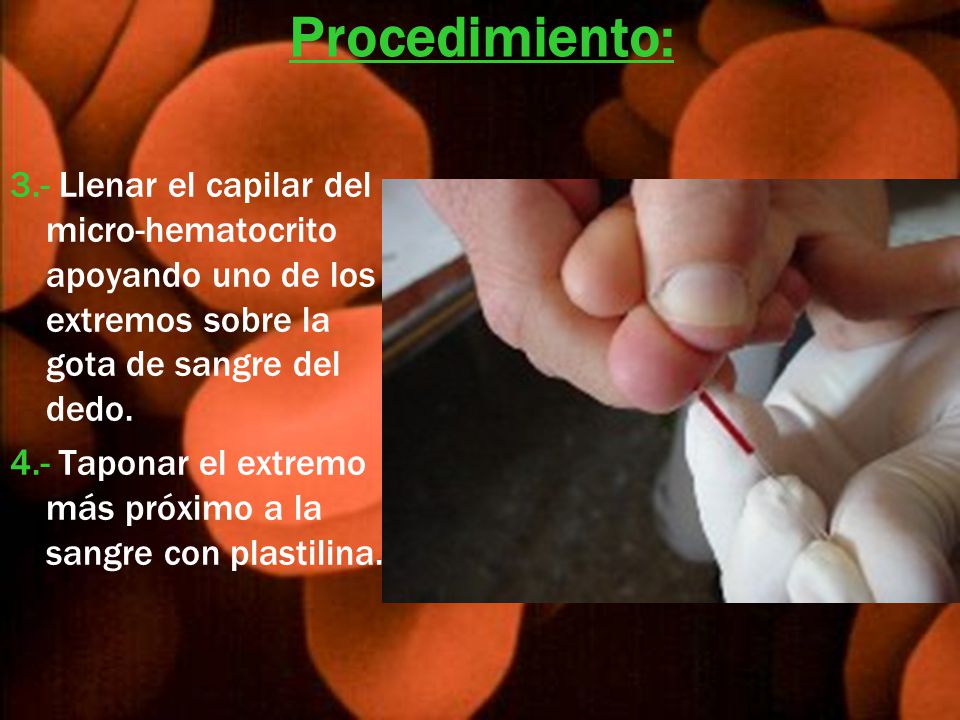 Procedimiento: 3.- Llenar el capilar del micro-hematocrito apoyando uno de los extremos sobre la gota de sangre del dedo.