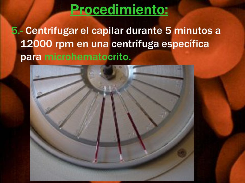 Procedimiento: 5.- Centrifugar el capilar durante 5 minutos a rpm en una centrífuga específica para microhematocrito.
