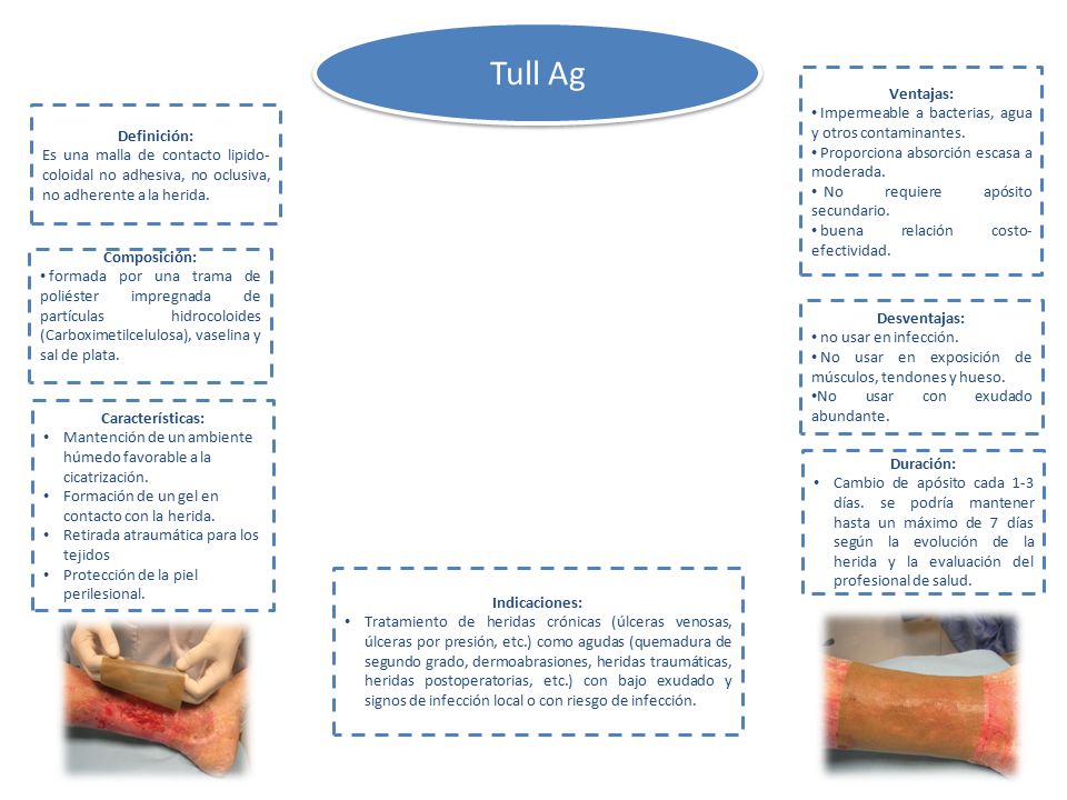 Tull Ag Ventajas: Impermeable a bacterias, agua y otros contaminantes.