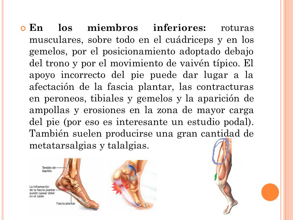 En los miembros inferiores: roturas musculares, sobre todo en el cuádriceps y en los gemelos, por el posicionamiento adoptado debajo del trono y por el movimiento de vaivén típico.