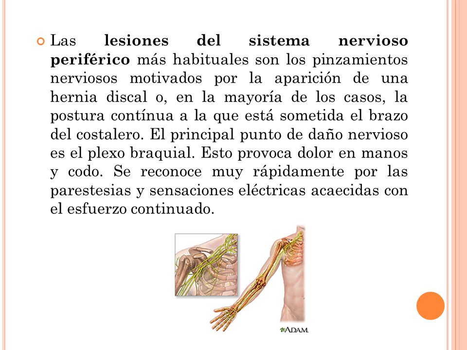 Las lesiones del sistema nervioso periférico más habituales son los pinzamientos nerviosos motivados por la aparición de una hernia discal o, en la mayoría de los casos, la postura contínua a la que está sometida el brazo del costalero.