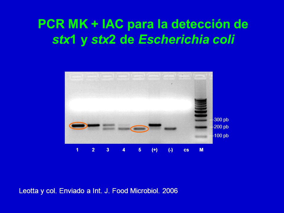 PCR MK + IAC para la detección de stx1 y stx2 de Escherichia coli