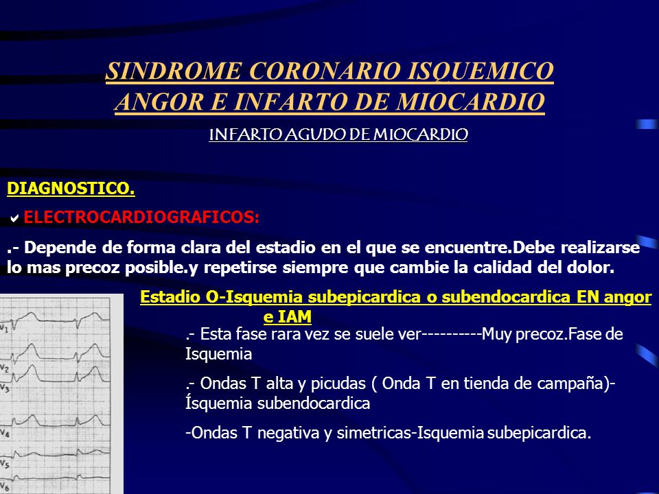 SINDROME CORONARIO ISQUEMICO ANGOR E INFARTO DE MIOCARDIO