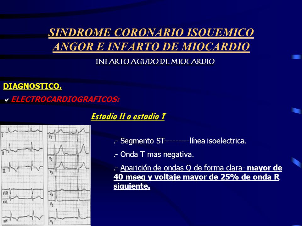 SINDROME CORONARIO ISQUEMICO ANGOR E INFARTO DE MIOCARDIO