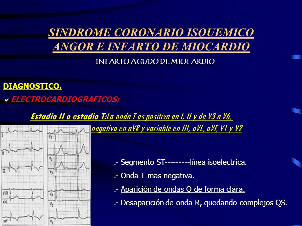 SINDROME CORONARIO ISQUEMICO ANGOR E INFARTO DE MIOCARDIO