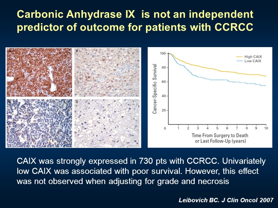 Carbonic Anhydrase IX is not an independent predictor of outcome for patients with CCRCC