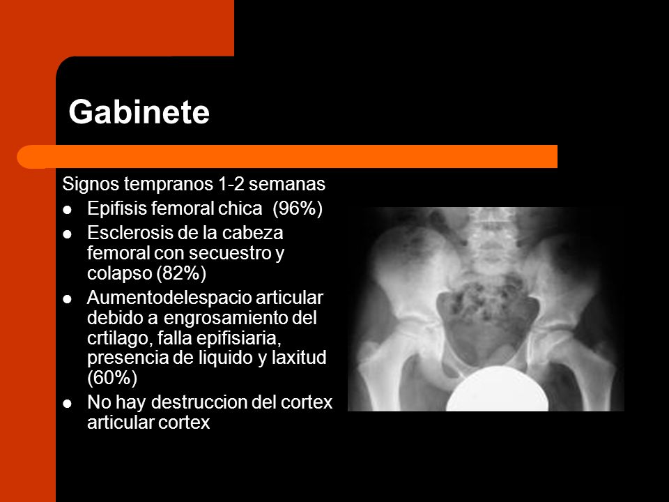 Gabinete Signos tempranos 1-2 semanas Epifisis femoral chica (96%)