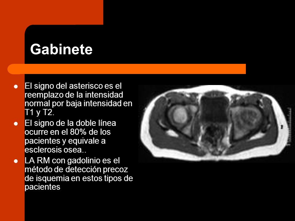 Gabinete El signo del asterisco es el reemplazo de la intensidad normal por baja intensidad en T1 y T2.