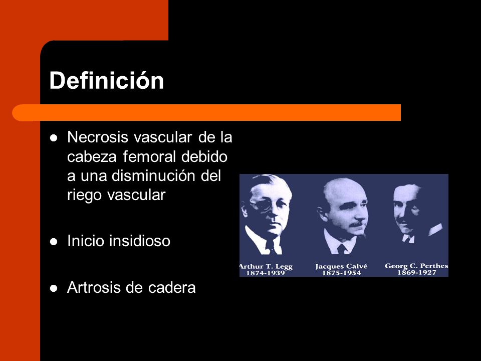 Definición Necrosis vascular de la cabeza femoral debido a una disminución del riego vascular. Inicio insidioso.
