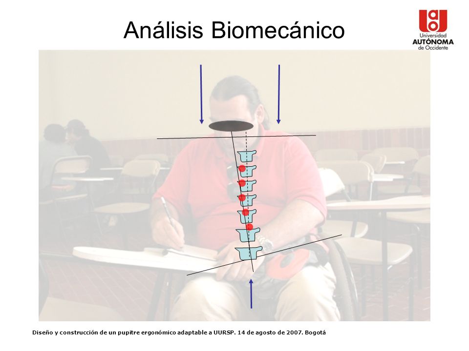 Análisis Biomecánico Diseño y construcción de un pupitre ergonómico adaptable a UURSP.