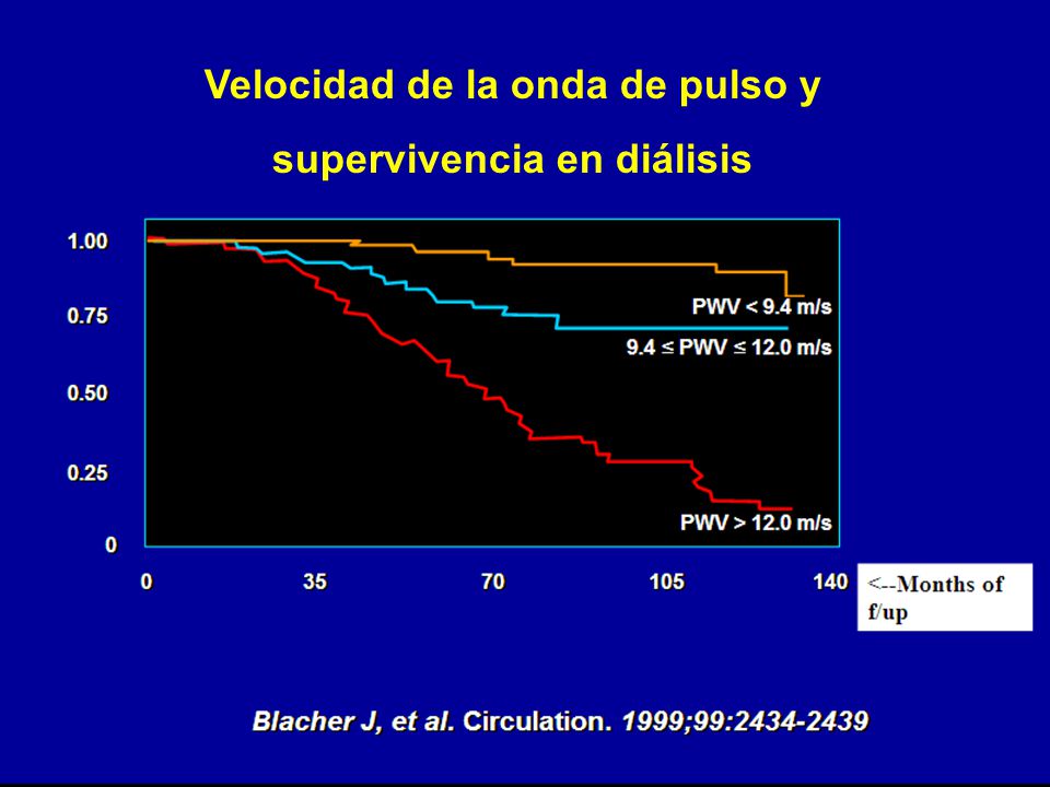 Velocidad de la onda de pulso y supervivencia en diálisis