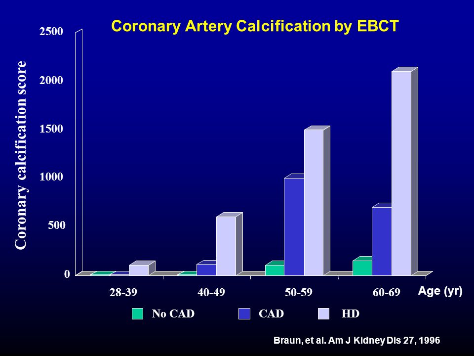 Coronary Artery Calcification by EBCT Coronary calcification score