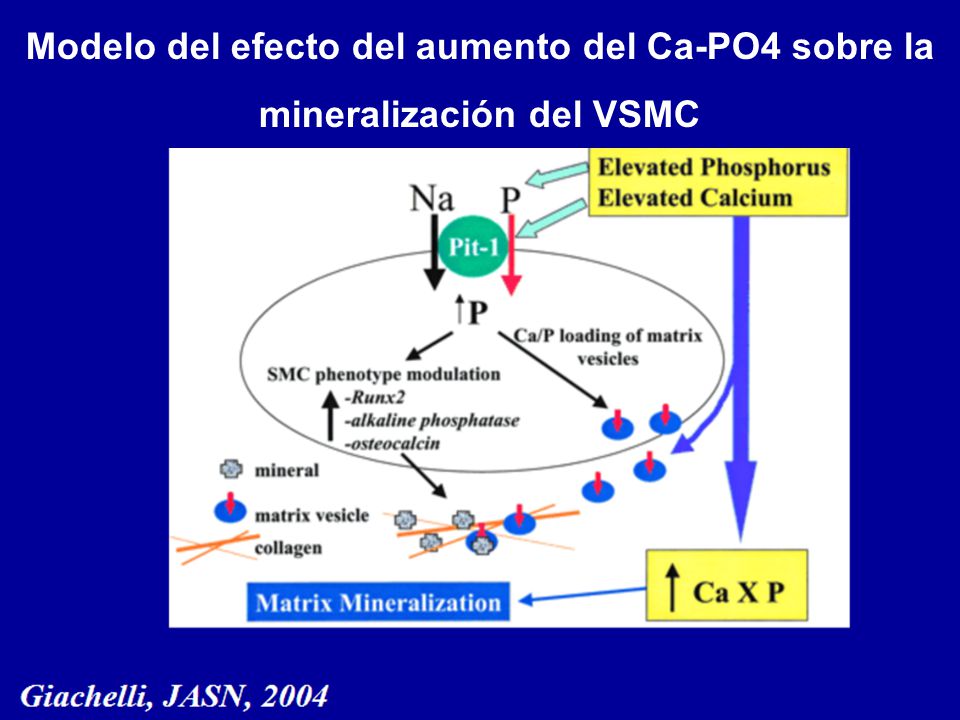 Modelo del efecto del aumento del Ca-PO4 sobre la mineralización del VSMC