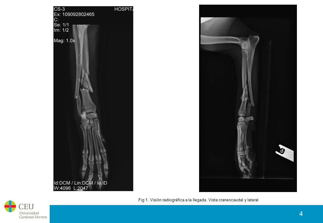 Fig 1. Visión radiográfica a la llegada. Vista craneocaudal y lateral