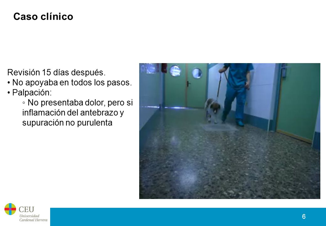 Caso clínico Revisión 15 días después. No apoyaba en todos los pasos.