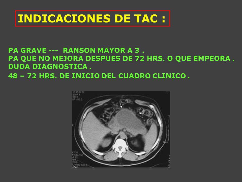 INDICACIONES DE TAC : PA GRAVE --- RANSON MAYOR A 3 .