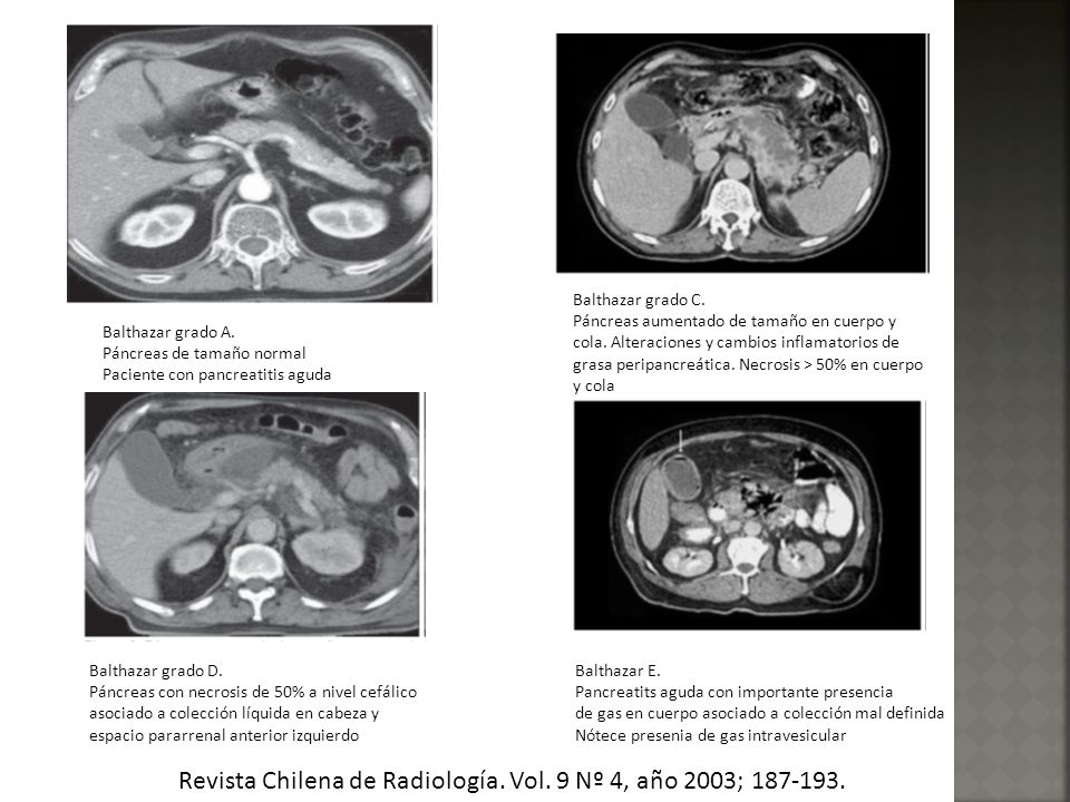 Revista Chilena de Radiología. Vol. 9 Nº 4, año 2003;