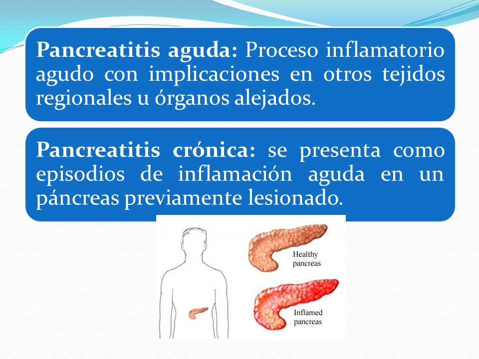 Pancreatitis aguda: Proceso inflamatorio agudo con implicaciones en otros tejidos regionales u órganos alejados.