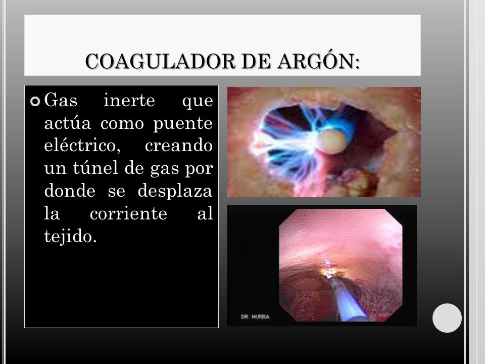 COAGULADOR DE ARGÓN: Gas inerte que actúa como puente eléctrico, creando un túnel de gas por donde se desplaza la corriente al tejido.