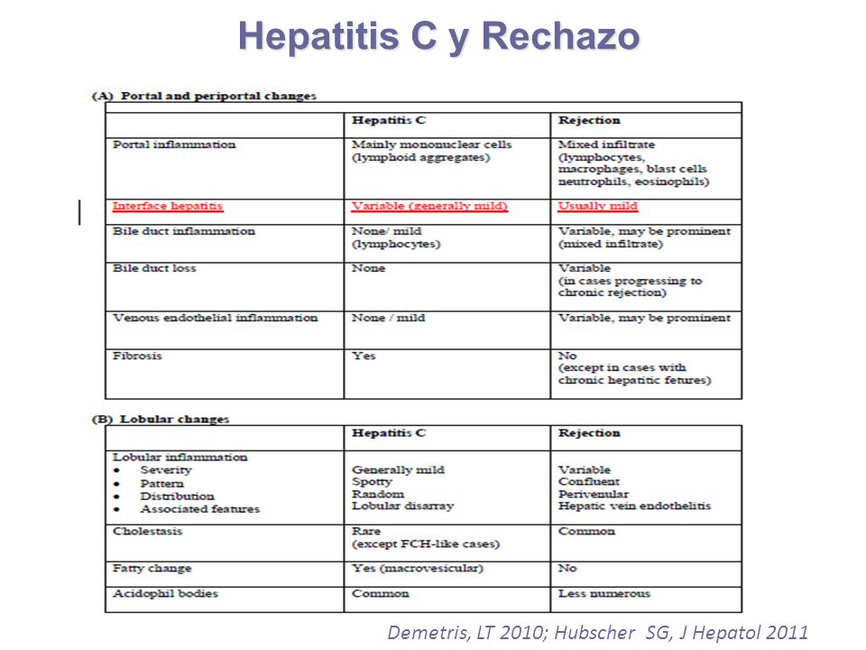 Hepatitis C y Rechazo Demetris, LT 2010; Hubscher SG, J Hepatol 2011