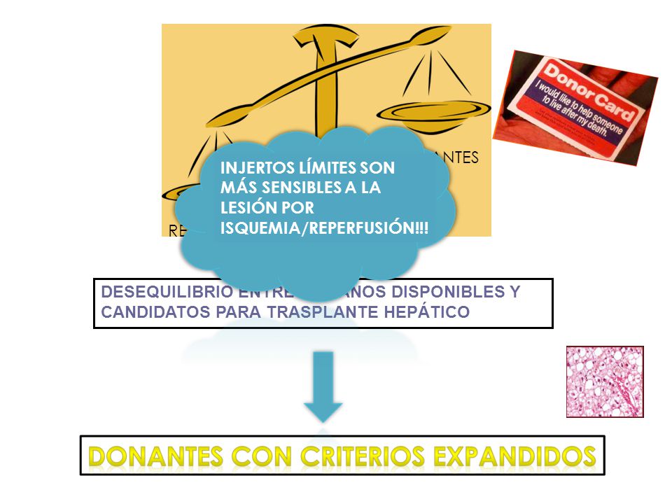 RECEPTORES DONANTES. INJERTOS LÍMITES SON MÁS SENSIBLES A LA LESIÓN POR ISQUEMIA/REPERFUSIÓN!!!