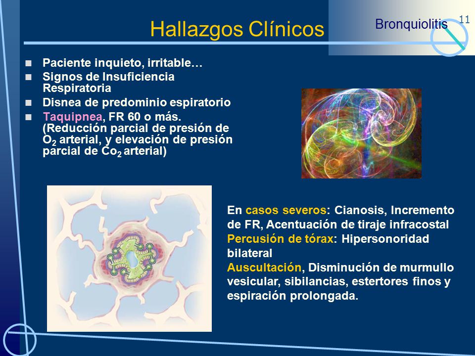 Hallazgos Clínicos Bronquiolitis Paciente inquieto, irritable…