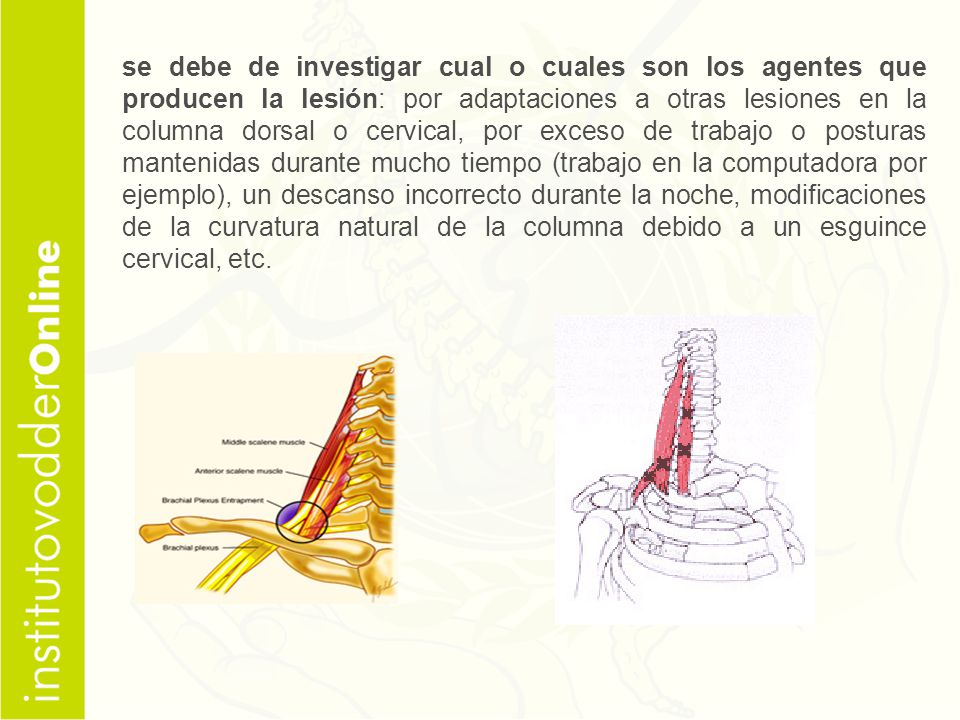 se debe de investigar cual o cuales son los agentes que producen la lesión: por adaptaciones a otras lesiones en la columna dorsal o cervical, por exceso de trabajo o posturas mantenidas durante mucho tiempo (trabajo en la computadora por ejemplo), un descanso incorrecto durante la noche, modificaciones de la curvatura natural de la columna debido a un esguince cervical, etc.