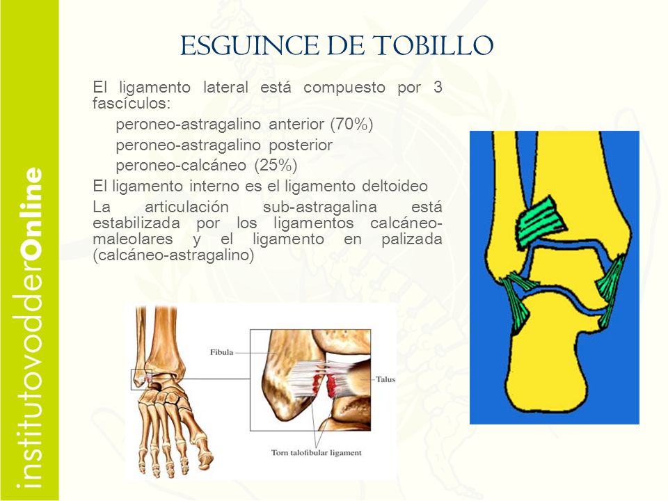 ESGUINCE DE TOBILLO El ligamento lateral está compuesto por 3 fascículos: peroneo-astragalino anterior (70%)