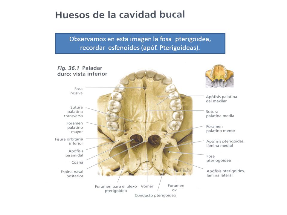 Observamos en esta imagen la fosa pterigoidea, recordar esfenoides (apóf. Pterigoideas).