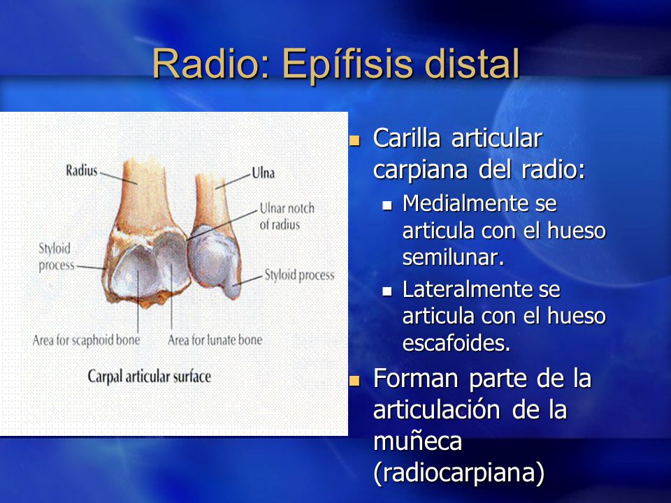 Radio: Epífisis distal