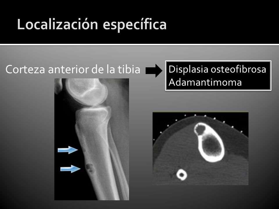 Localización específica