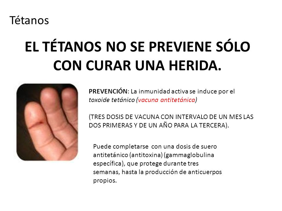 EL TÉTANOS NO SE PREVIENE SÓLO CON CURAR UNA HERIDA.