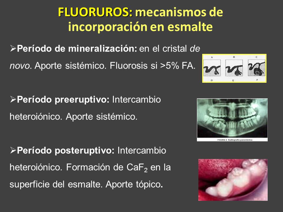 FLUORUROS: mecanismos de incorporación en esmalte