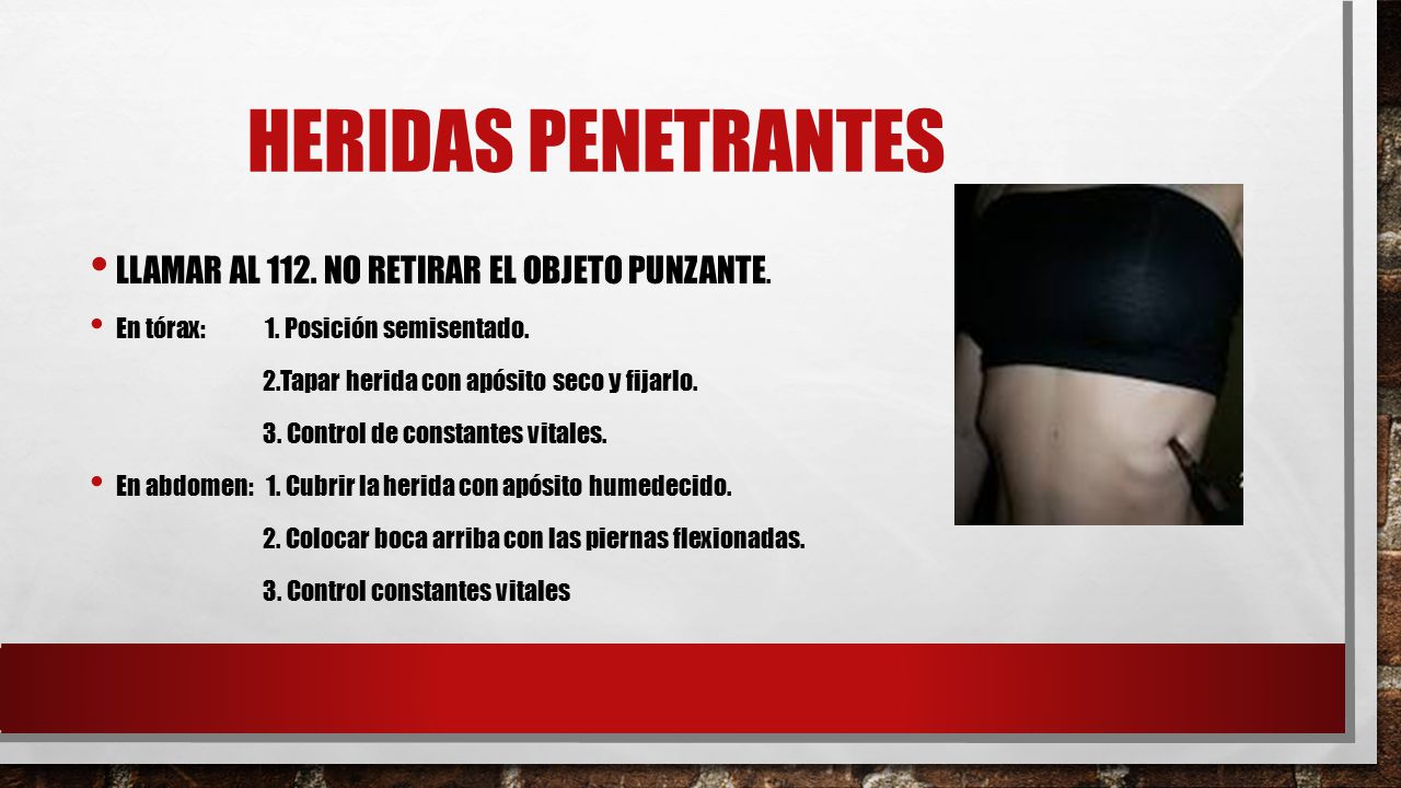 HERIDAS PENETRANTES LLAMAR AL 112. NO RETIRAR EL OBJETO PUNZANTE.