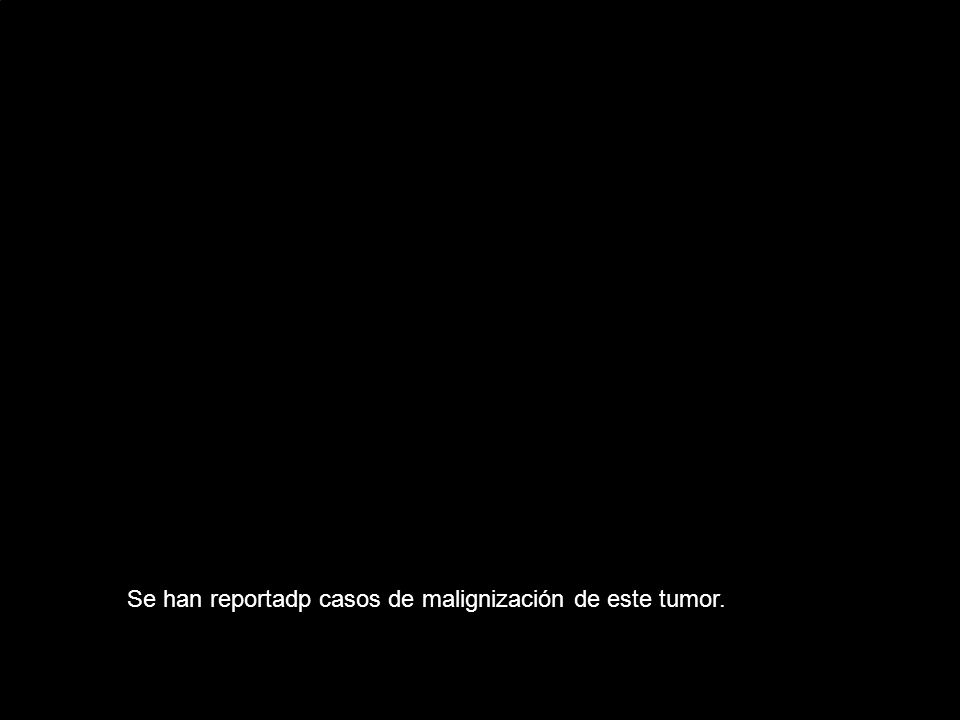 Se han reportadp casos de malignización de este tumor.