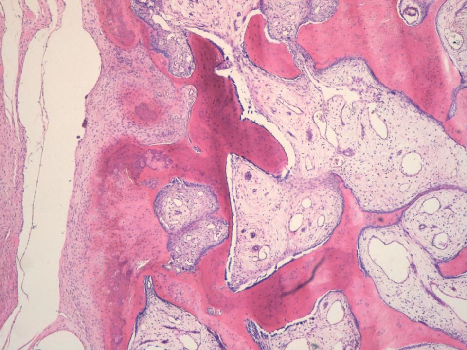 La capa fusocelular, seguida de cartilago, osteoide, ribete osteoblastico, estroma central laxo, que si concordaba con lo visto en el cilindro