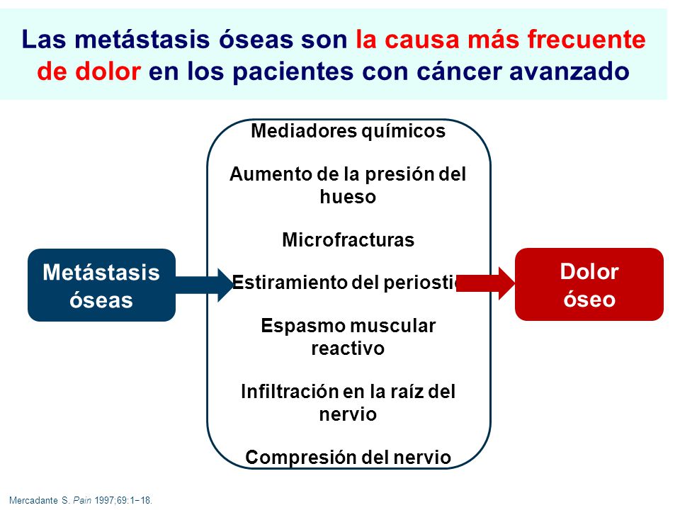Las metástasis óseas son la causa más frecuente de dolor en los pacientes con cáncer avanzado