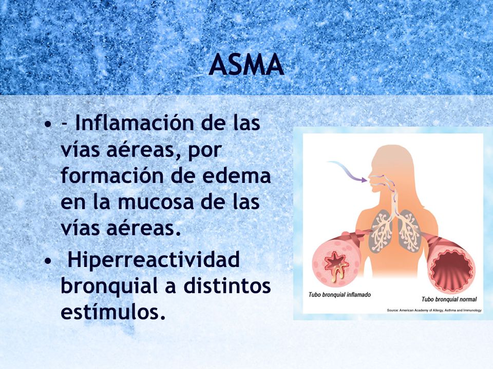 ASMA - Inflamación de las vías aéreas, por formación de edema en la mucosa de las vías aéreas.