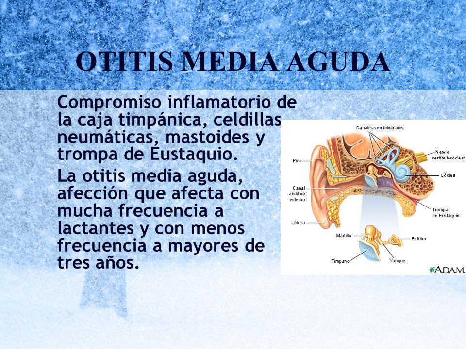 OTITIS MEDIA AGUDA Compromiso inflamatorio de la caja timpánica, celdillas neumáticas, mastoides y trompa de Eustaquio.