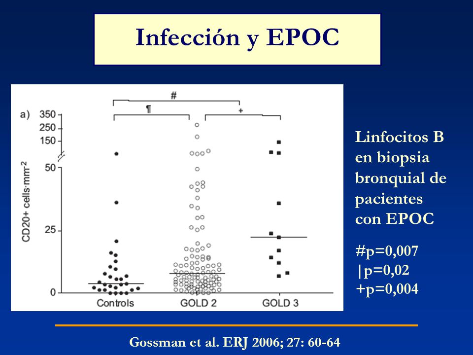 Infección y EPOC Linfocitos B en biopsia bronquial de pacientes con EPOC. #p=0,007. |p=0,02. +p=0,004.