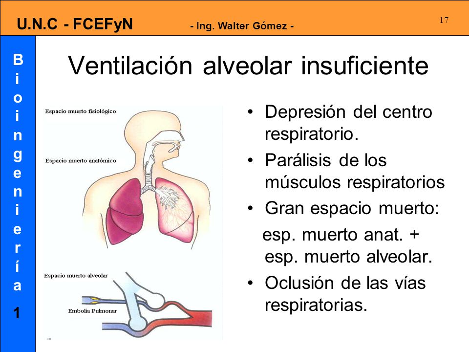 Ventilación alveolar insuficiente