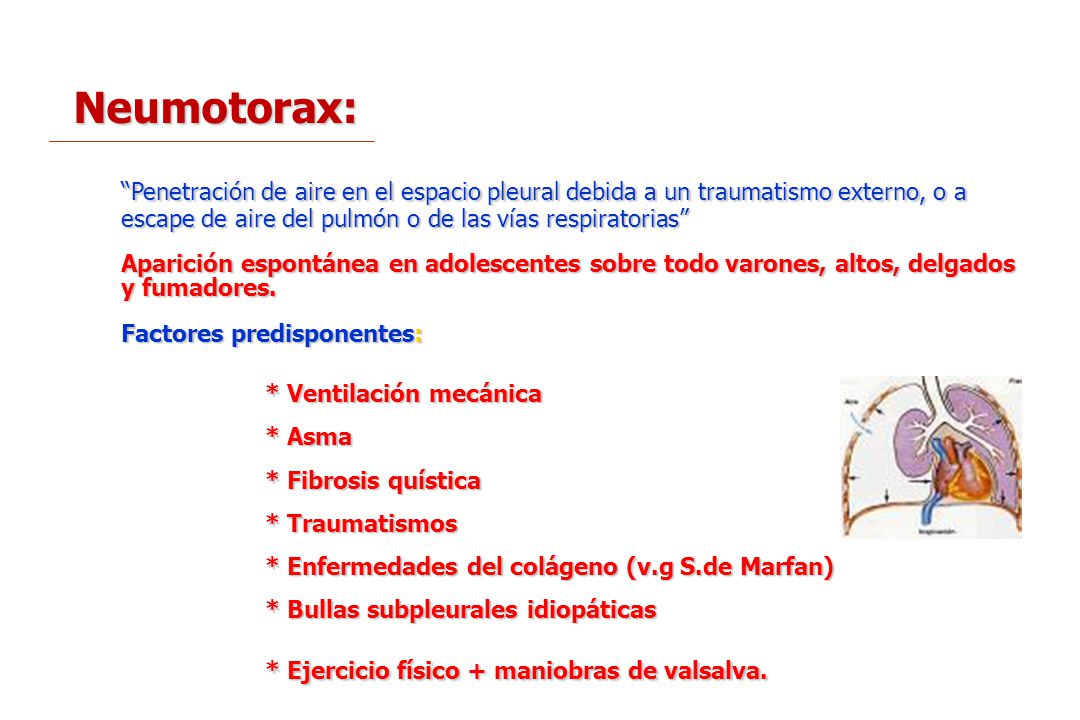 Neumotorax: Penetración de aire en el espacio pleural debida a un traumatismo externo, o a escape de aire del pulmón o de las vías respiratorias