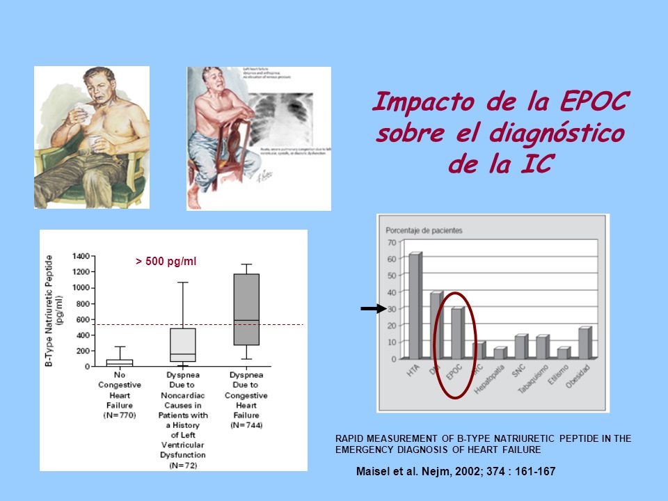 Impacto de la EPOC sobre el diagnóstico de la IC