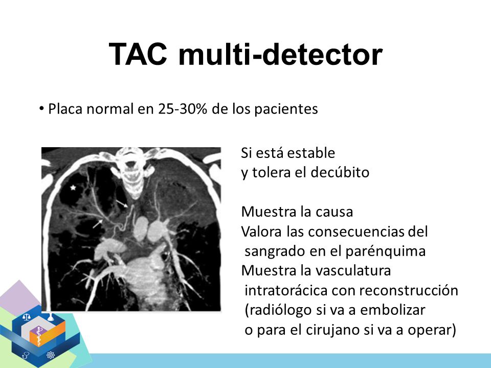 TAC multi-detector Placa normal en 25-30% de los pacientes